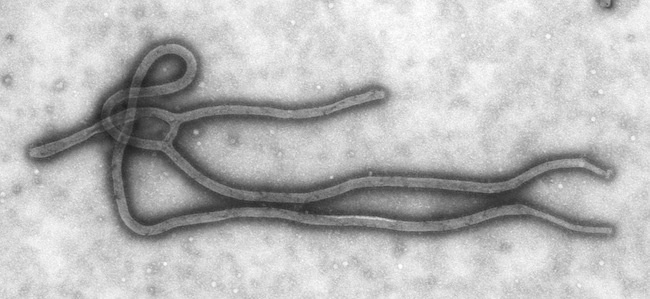 Ebola : la Serbie applique le principe de précaution, aucun cas signalé